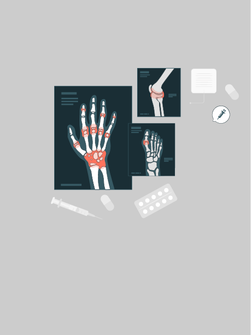 Musculoskeletal